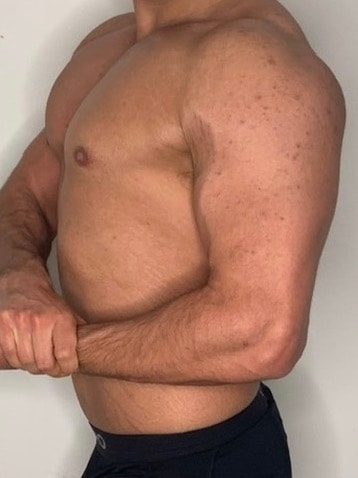 Nico vorher